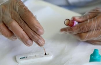 SMS promove ação em combate a Aids no Farol da Barra