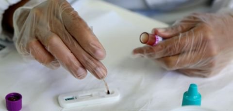 SMS promove ação em combate a Aids no Farol da Barra